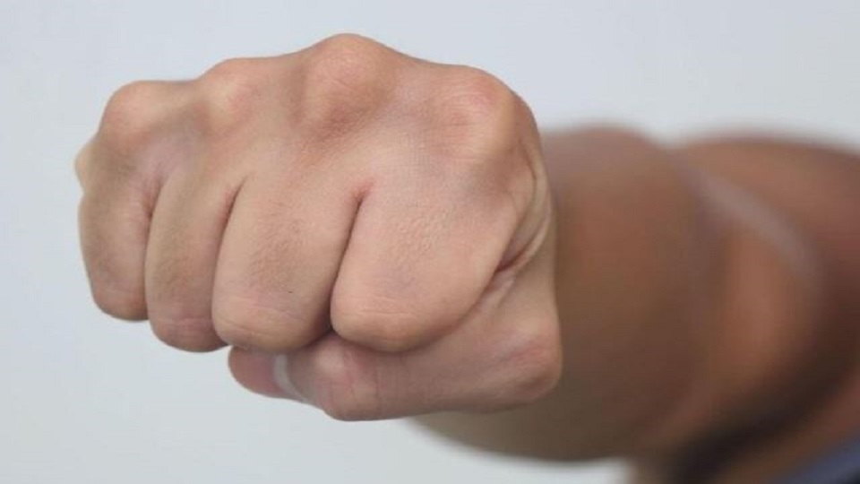 Nainital News: मैच के बाद खिलाड़ी ने रेफरी को जड़ दिया घूंसा, घायल का अस्पताल में कराया उपचार; जानिए मामला